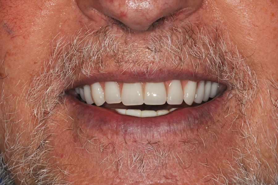 smile in a day 9 after